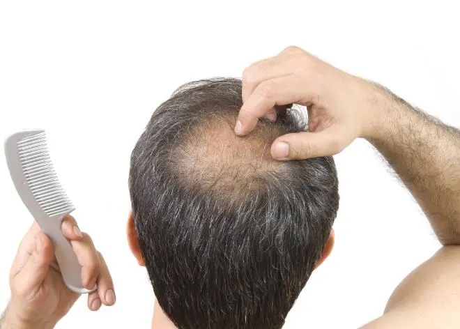 Why do many people say that NMN can solve hair loss